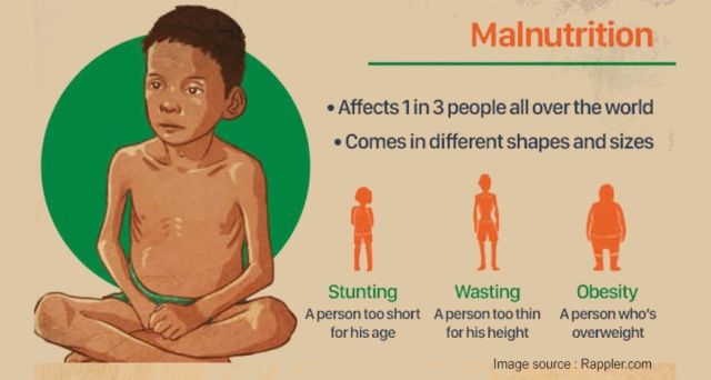 Malnutrisi Bayi: Waspada Gejalanya